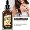 Hair-Growth-Serum-Votala-Hair-Growth-Treatment-Hair-Serum-Anti-Hair-Loss-Thinning-Balding-Repairs-Hair-Follicles-Promotes-Thicker-Stronger-Hair-And-Promotes-Hair-Regrowth Hair Growth Serum, VOTALA Hair Growth Treatment, Anti Hair Loss, Promotes Thicker, Stronger Hair, And Hair Regrowth for Men Women