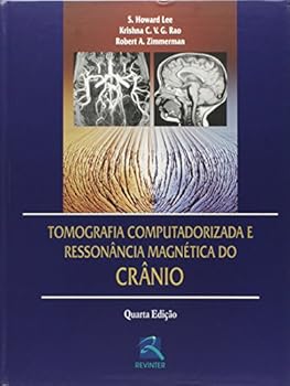 Hardcover Tomografia Computadorizada E Ressonancia Magnetica Do Cranio [Portuguese] Book