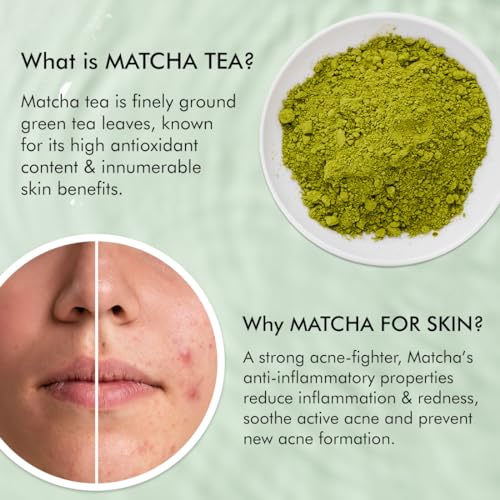 mCaffeine 1% Salicylic Acid Acne Arrest Spot Corrector with 1% Succinic Acid & Matcha Tea | Anti Acne Gel for Active Acne & Acne Scars | Reduces... - Image 4
