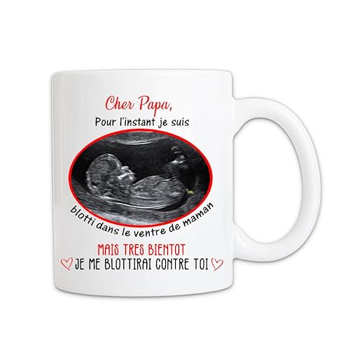 mug-personnalise-avec-echographie