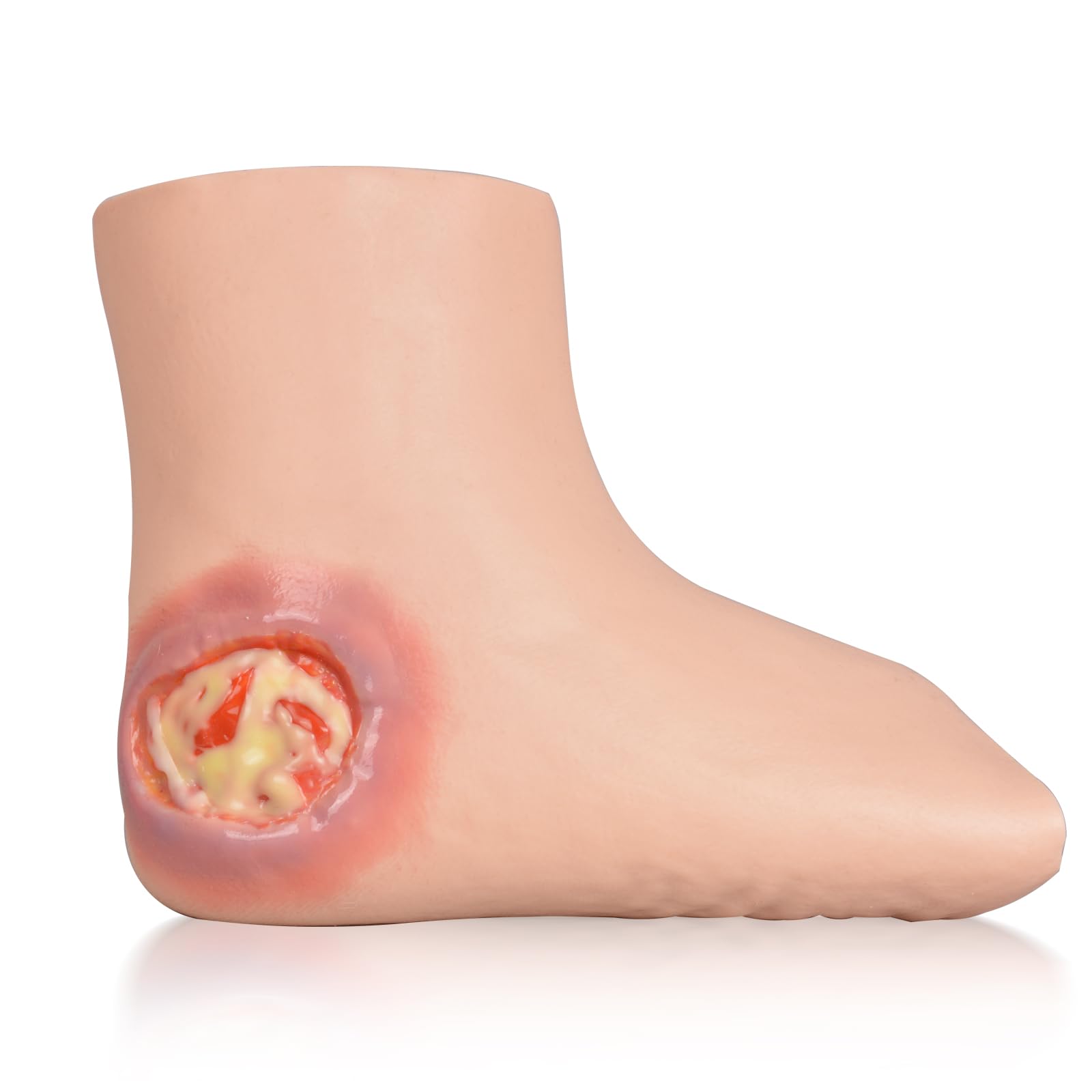 Wearable Heel Ulcer Wound Training Sleeve, Realistic Silicone Foot Model for Decubitus Ulcer Care Practice and Demonstration
