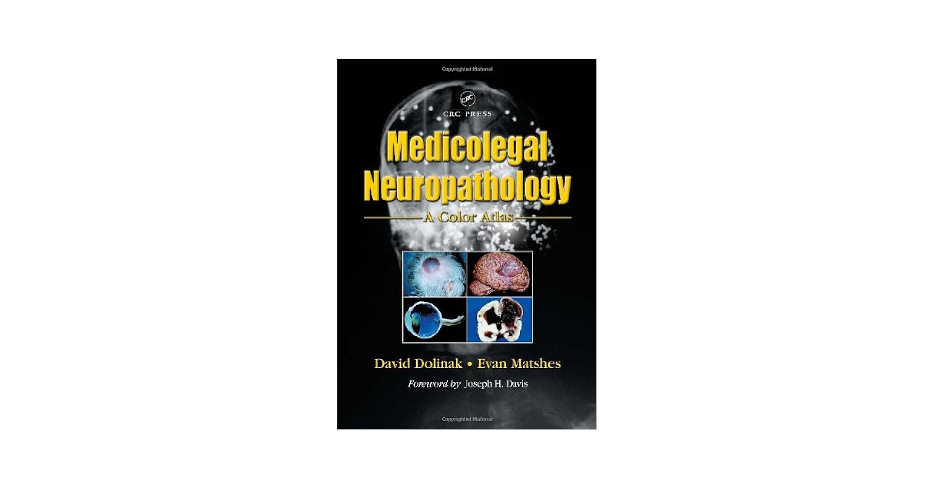 Medicolegal Neuropathology: A Color Atlas: 9780849313615