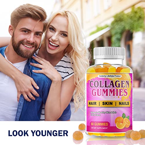 Collagen Gummies With Biotin For Women And Men, Collagen Supplements Strengthen Hair, Skin And Nails, 200Mg Of Hydrolyzed Collagen, Vitamin C & Biotin, Gluten-Free, Non-Gmo- 60 Fruity Flavored Gummies #TOP7