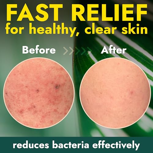 Image of Antibacterial Body Wash with Tea Tree Oil for Back Acne & Skin Irritation