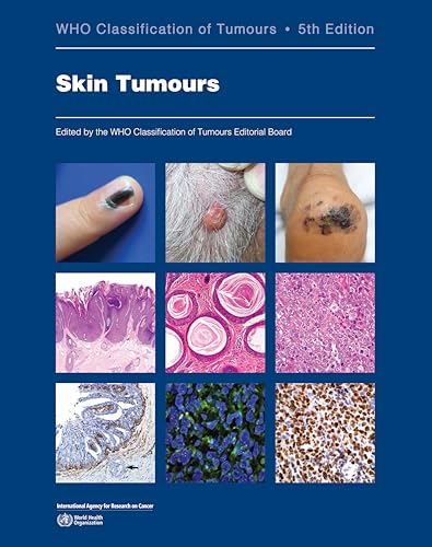Best Skin And Coat Supplement For French Bulldogs For 2023 8 Skin Tumours: WHO Classification of Tumours