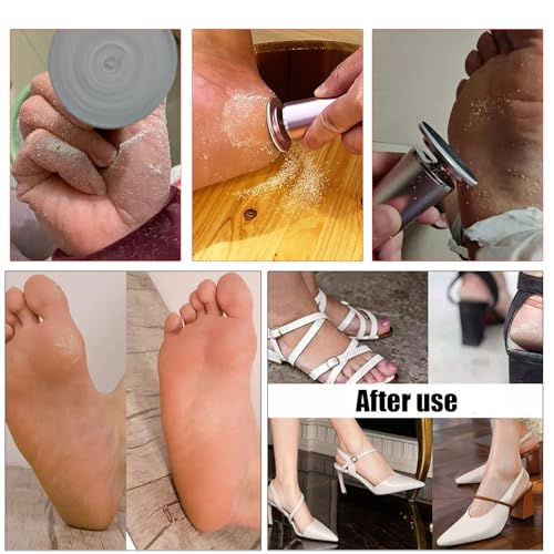 Hannah.Qi Electric Foot File Callus Remover Professional Foot File Pedicure Tools Adjustable Speed 60Pcs Replacement Sandpaper Disc Easy To Remove Cutin Dead Skin Calluses thumb #3