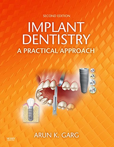 Implant Dentistry - E-Book: A Practical Approach
