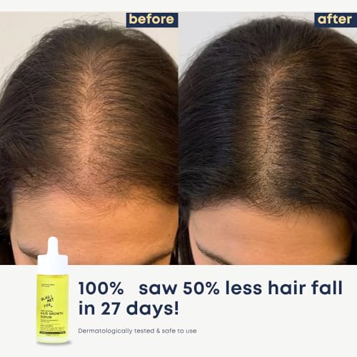 Image of Hair Growth Serum + Anti Dandruff & Hair Fall Control Shampoo | Rosemary, Castor, Bhringraj, Tea Tree, Neem & more| Reduces Hair Fall & Controls Dandruff | Sulphate Free (40ml + 100ml)