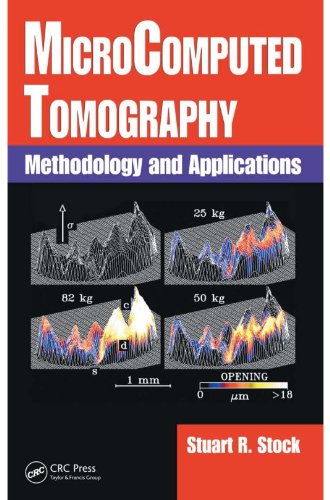 MicroComputed Tomography: Methodology and Applications MicroComputed Tomography: Methodology and Applications