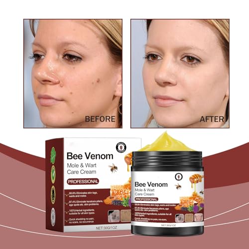 Generic Wart Removal Cream, Tag Recede Bee Venom,Bee Venom Mole And Wart Treatment Cream,Wart Removal Gel, Moisturizer,Bee Venom Cream,Common Wart, Warts, Plantar Wart Remover For Feet thumb #7