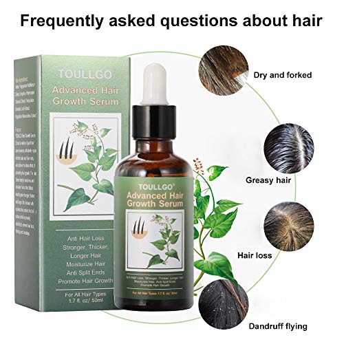 Hair Growth Serum for Thicker, Longer, Fuller Hair - Prevents Loss and Thinning with Vitamin-Rich Natural Treatment