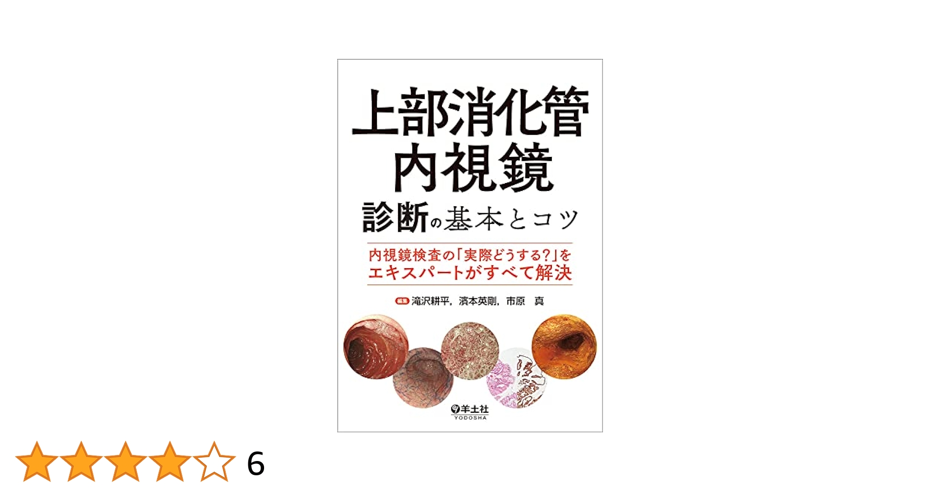 【裁断済】上部消化管内視鏡診断の基本とコツ 510t9HPOLML.jpg_BO30,255,255,