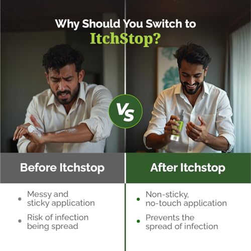 Image of ItchStop Antifungal Spray for Women & Men | Hands-Free Ayurvedic & Herbal Formula - Anti Bacterial, Anti Itch, Anti Chafing & Anti Fungus for Skin Fungal Infection on Thighs, Feet, Back, Hand, Underarm, Private Parts & Nail | Fast-Acting on Ringworm, Eczema, Redness, Jock Itch, Itchy Skin & Irritation | Safe for Daily Use 35ml (Pack of 1)