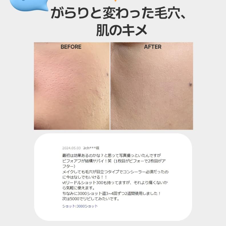 Amazon.co.jp: ECLIMOI(イクリモイ)ダイヤリフトショット1000 毛穴