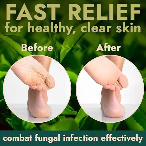 foot scrub with tea tree oil  callus remover for feet  exfoliating scrub with salicylic and glycolic acid for dead skin athletes foot warts corns rashes foot odor insect bites and foot care