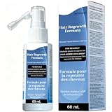 Minoxidil Hair Growth Serum 5% for Women and Men, Hair Growth Spray with Rosemary & Biotin & Caffeine for Hair Thickening & Strengthening