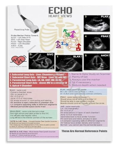 Echocardiogram Heart Views Poster Ultrasound Guide for Students and Anatomy Study(Framed,16x24inch(40x60cm))