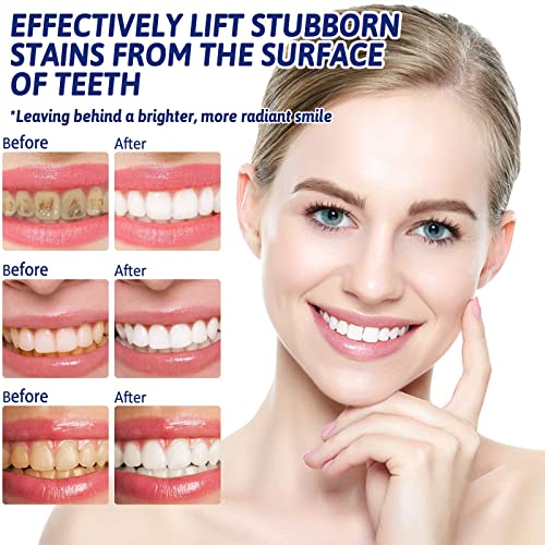 Teeth Whitening Pen, Effective & Painless Teeth Whitening Kit, 2Pack, 40+ Uses, Mild No Sensitivity Teeth Whitener, Easy To Use, Obvious Effect Instant Smile, Natural Mint Flavor Teeth Whitening Gel #TOP6