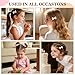 choicbaby 20pcs Baby Girl Hair Bow Clips 2