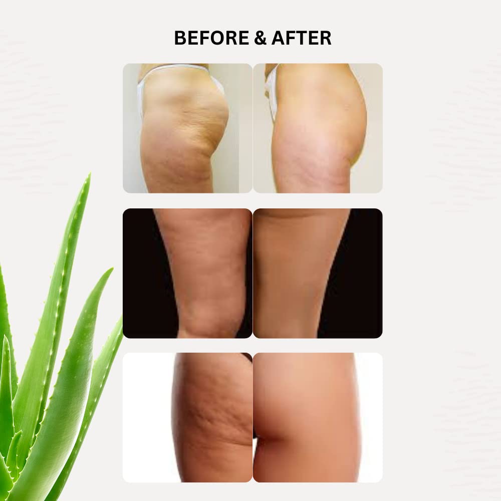 CMP Anticellulite + Reduction + Firming Body Intensive Gel. Cellulite and Orange Peel Remover. Massage Gel for Professional Treatment. (Cabin - Image 2