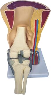 Human Knee Joint Skeleton Model, 4 Stages Osteoarthritis Knee Joint Model, with Ligaments and Muscle, for Knee Joint Disease Medical Research, Educational Use