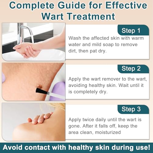 Image of Skin Tag Remover,Wart Remover Freeze Off Liquid with 17% Salicylic Acid - Fast-Acting Freeze Off Treatment for Common & Plantar Warts,Flat Wart, Corns - for Feet, Hands & Body 1Ounce