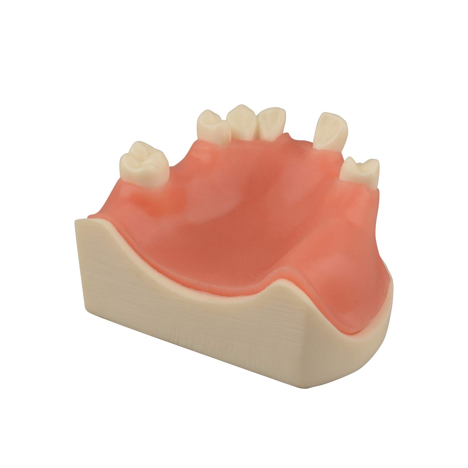 Ultrassist Maxillary Dental Implant Model, Basic Implant Training Model with Practice Soft Gums, Great Dental Training Tooth for Dental Implant Practice