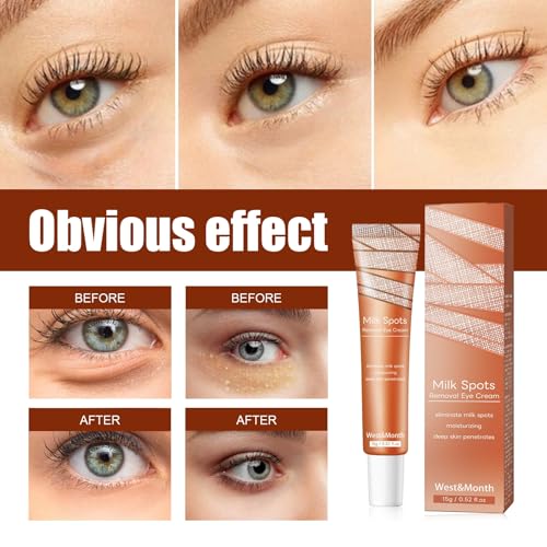 Milia Removal Eye Creams,Milia Spot Treatment Eye Cream,Eye Cream Anti Aging,Dissolve and Reduce Milia Eye Cream,Dark Circle Eye Cream,Eye Care Products,Instant Wrinkle Remover Eye Cream,15g - Image 3