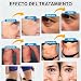 Imagen de Máquina HIFU 7D de Lifting Facial y Corporal