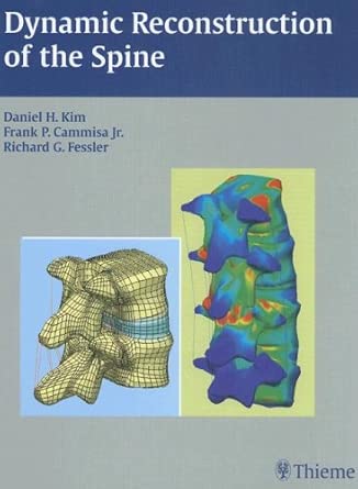 Dynamic Reconstruction of the Spine book cover