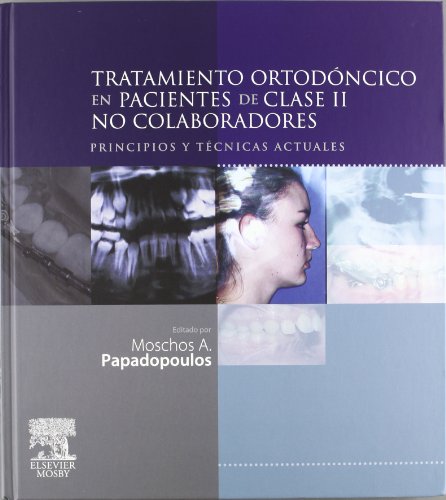 Portada de Tratamiento ortodóncico pacientes clase 2 no colaboradores Principios