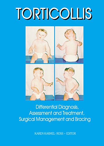 Torticollis: Differential Diagnosis, Assessment and Treatment, Surgical Management and Bracing
