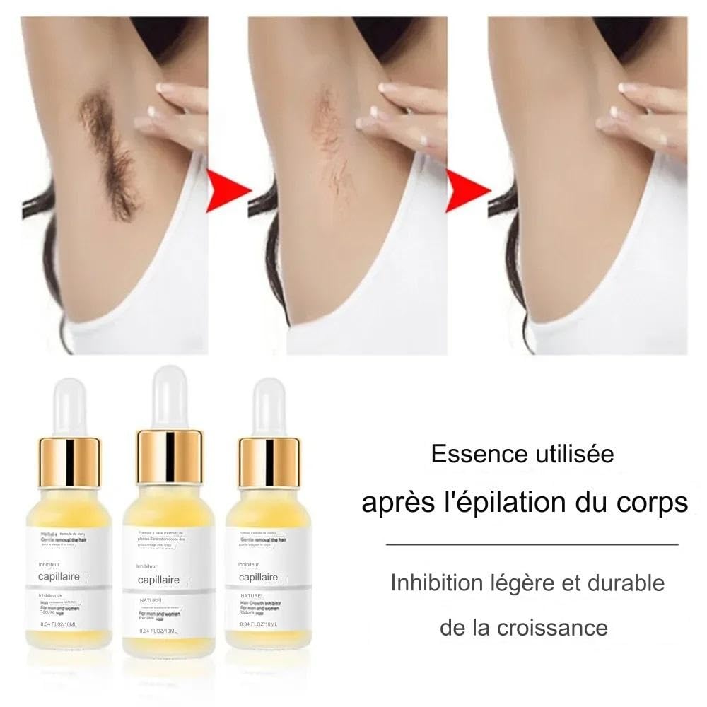Anti-Nachwachs-Serum, Haarentfernungs-Serum für Damen und Herren, schmerzlos, schnelles Ergebnis, bekämpft eingewachsene Haare