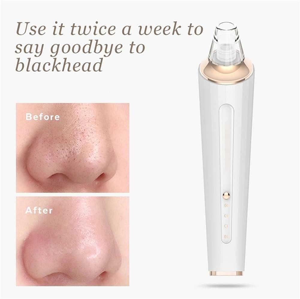 Blackhead Remover Pore Vacuum Cleaner - Blackhead Removal Tool,Pore Cleaner Electric