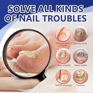 32 Pezzi Cerotti Progettato Ispessire L'Unghia, Cerotti Per Unghie, Cura Delle Unghie, Nutrire Idratare, Rafforzare E Migliorare L'Aspetto Nail Delle, Per Nail Di Mani E Piedi