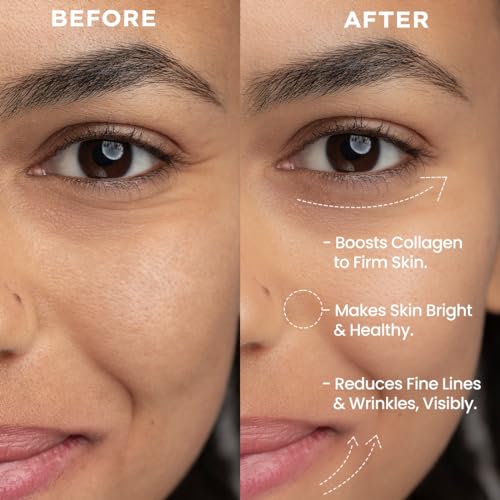 Image of Hyphen 0.05% Retinal Reset Serum | 30% More Effective than Retinol Serum | Anti Ageing Reduces Fine Lines & Wrinkles Night Face Serum For Beginners | Serum for Women | Boosts Collagen & Brightens Skin- 30 ml