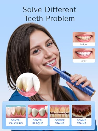 Ultrasonic Plaque Remover with Smart Gum Protection