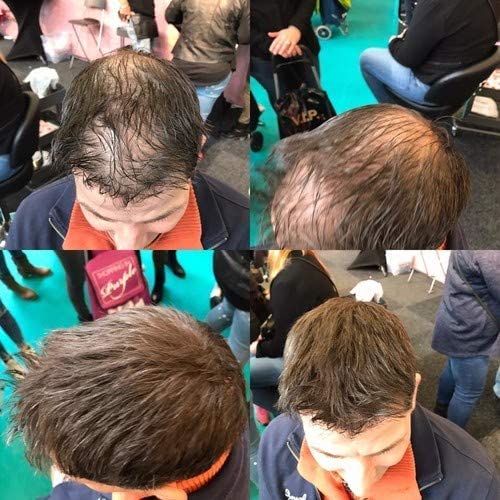 Miniatura 4 de 4 fibras de construcción de cabello de 1.76 oz (1.76 onzas), polvo para el cabello para mujeres y hombres, adelgazamiento, espesante y cobertura