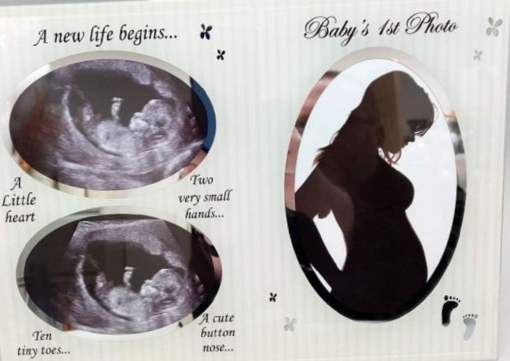 Baby First Scan Photo - Glass three picture photo frame baby scan sonogram