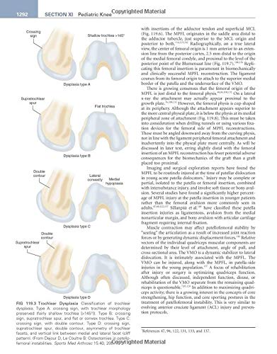 Insall & Scott Surgery of the Knee, 2-Volume Set: Expert Consult - Online and Print