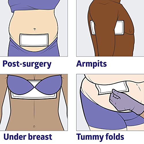 image for Medline Skinfold Dry Sheet, Skin Moisture Management, Soft, Non-Chafin