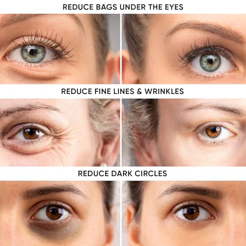 beatool Instant Ageless Eye Cream-Instantly Reduces Under Eye Bags, Wrinkles, Dark Circles, Fine Lines & Crow's Feet. Powerfully Tighten & Lifts Sagging Skin that last Hours