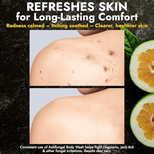 Image of Antifungal Body Wash with Tea Tree Oil & Lemon Oil, 1% Tolnaftate Scrubber