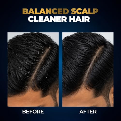 Image of Beardo Studio Professional Scalp Balance Shampoo for Men | Salon-Grade Scalp Care at Home | Deep Cleansing Shampoo with Climbazole & Menthol | Helps Control Dandruff, Excess Oil & Itchy Scalp | 200ml
