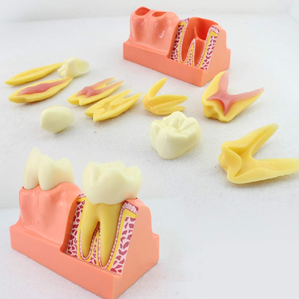 Stampe Artistiche Di Anatomia Dentale: Decorazioni Per Studio Dentistico Rosa E Blu Navy (download Digitale) - Italia