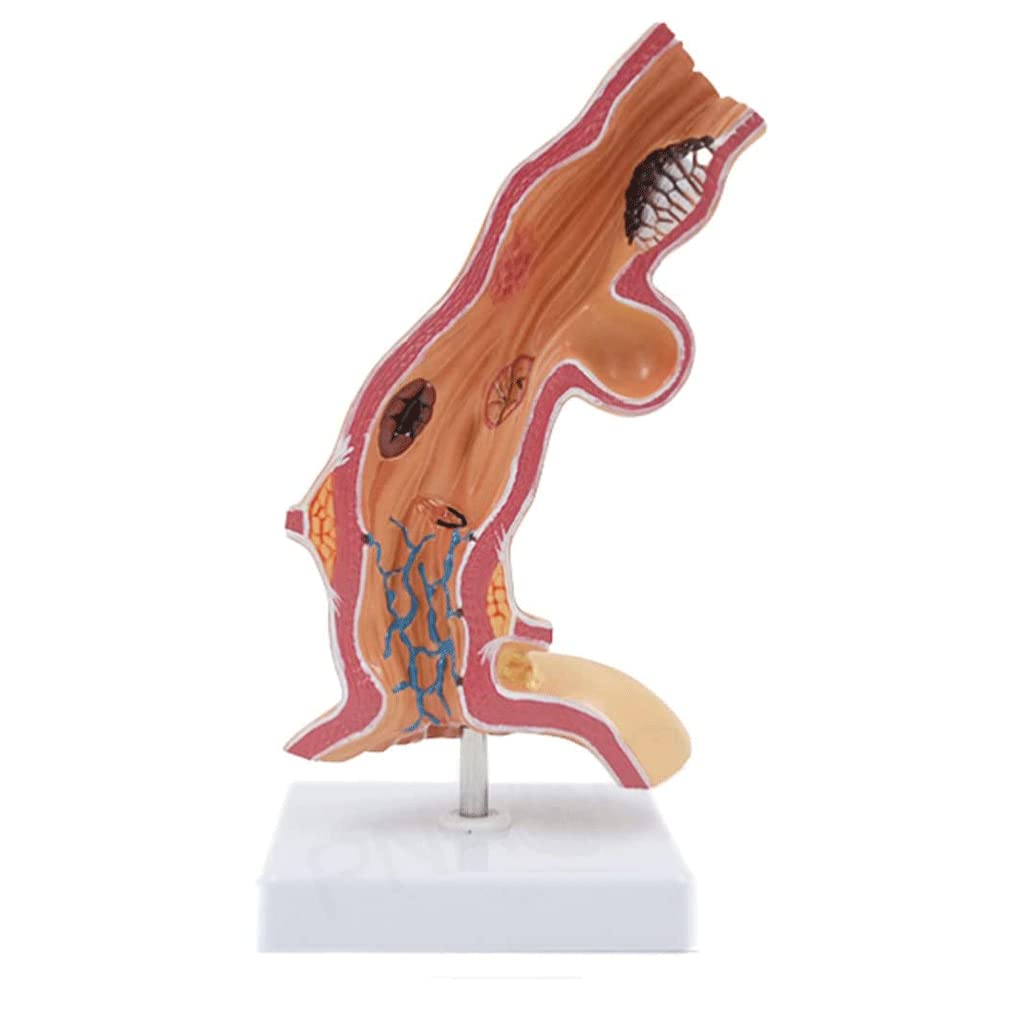 GTHTUHFD Skeleton Model Esophageal Anatomy Model Human Digestive System Model Anatomy Model Human Body Model For Teaching Learning And Display