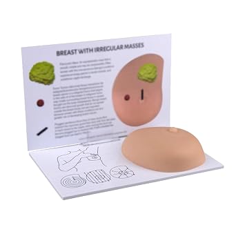 Breast Model Manikins, Breast with Cancer Anatomical Model, Silicone Pathological Lumps Breast Self Test Mannequins for Doctor-Patient Communication, Medical Student Teaching