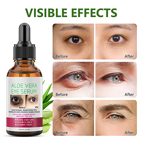 Eye Serum Eye Treatment Products, Aloe Vera Under Eye Brightener, Anti Aging Eye Serum For Dark Circle And Puffiness Dark Circle Under Eye Treatment For Women Hydrating Eye Serum For Bag Wrinkle 1Floz #TOP1