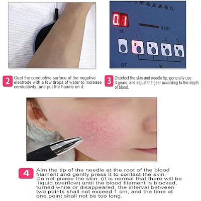 Varicose Vein Treatment Device, DIY Vein Removal Pen, 4 Adjustable Power Levels, 5-Button Smart Control, for Home or Clinic Use, Beauty Salon