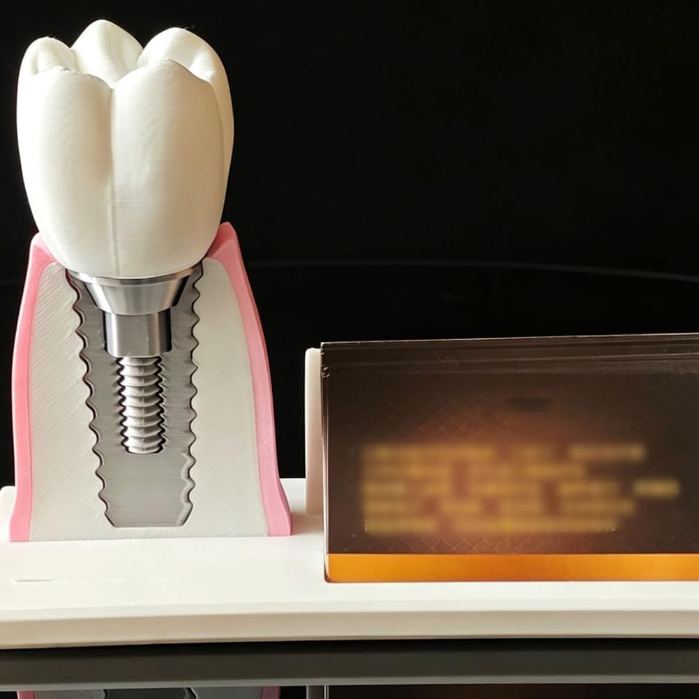 Soporte para Tarjetas de presentación Dental de Resina, Modelo Dental y Modelo de implante Dental, Soporte para Tarjetas de presentación, Adorno de Modelo de conducto radicular